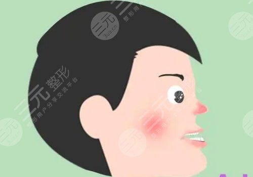正頜手術(shù)風險大嗎