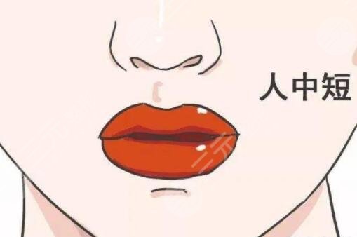 張曼醫(yī)生做人中縮短手術(shù)大概多少錢？