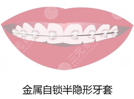 上海七醫(yī)院口腔科環(huán)境怎么樣?