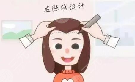 植發(fā)