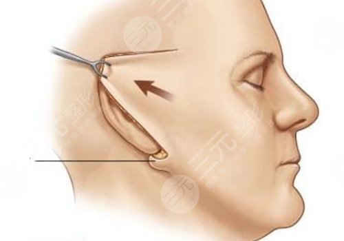 鄭州集美做拉皮的醫(yī)生是誰