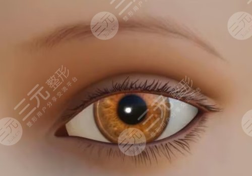 鄭州集美做眼綜合雙眼皮怎么樣