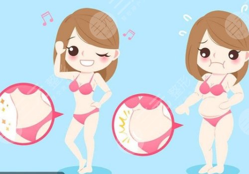 廣州做吸脂手術(shù)多少錢