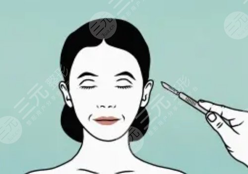 拉皮手術(shù)能維持幾年