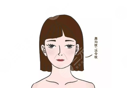 拉皮手術(shù)能維持幾年