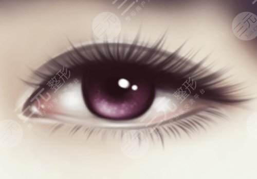 上海第九人民醫(yī)院王業(yè)飛雙眼皮割的怎么樣