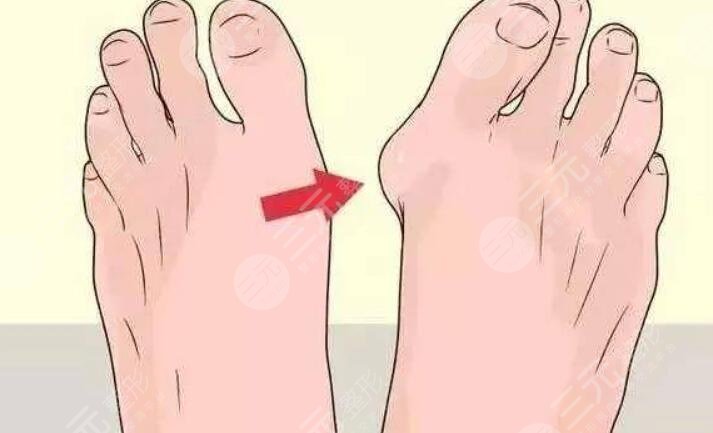 大腳骨