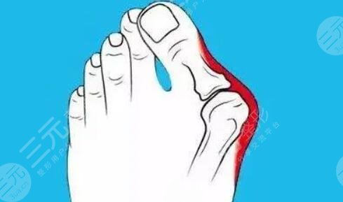 大腳骨