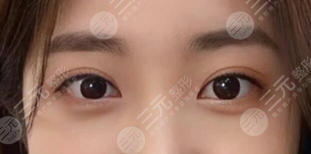 肖貴喜醫(yī)生做雙眼皮怎么樣??？醫(yī)生個人實力測評，就職醫(yī)院是哪家？