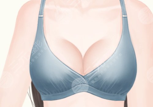 鄭州楊麗美顏隆胸價(jià)格