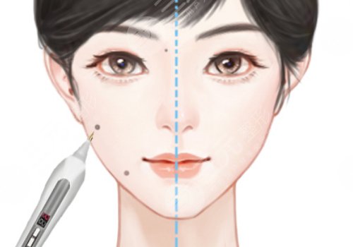 臧夢青案例
