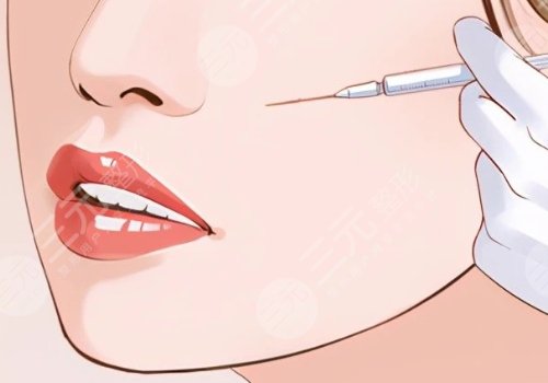 錢寧醫(yī)生取面部不明注射物怎么樣