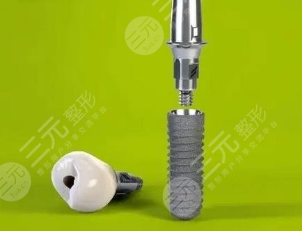 上海第八人民醫(yī)院種植牙案例分享
