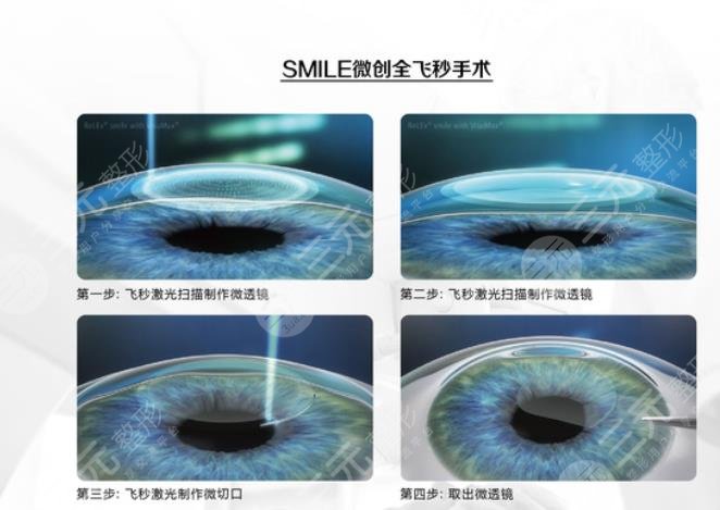 安醫(yī)大一附屬醫(yī)院眼科專家