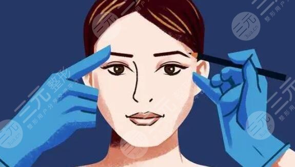 雙眼皮修復(fù)