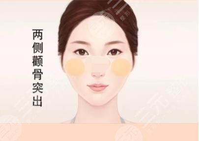顴骨內(nèi)推