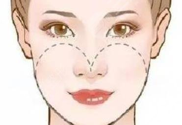 磨骨