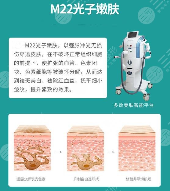 光子嫩膚