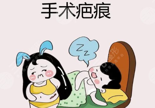 臧夢青疤痕切除縫合