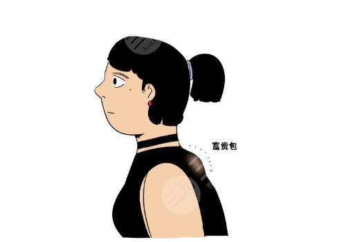 上海第九人民醫(yī)院富貴包看什么科