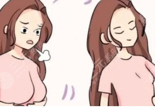 九院徐華縮胸費用