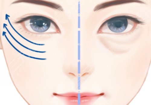 上海九院眼袋哪個醫(yī)生好 