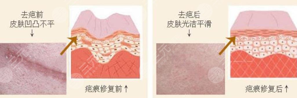 北京醫(yī)院丁金萍切痣怎么樣?
