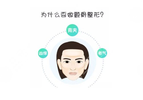 上海第九人民醫(yī)院顴骨內推手術 