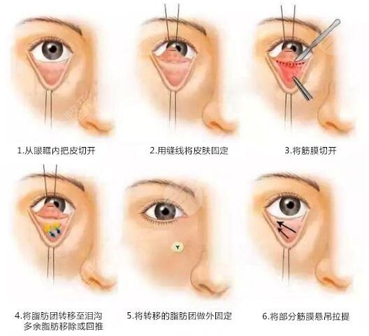 南方醫(yī)院袁藝厚唇改薄術(shù)怎么樣