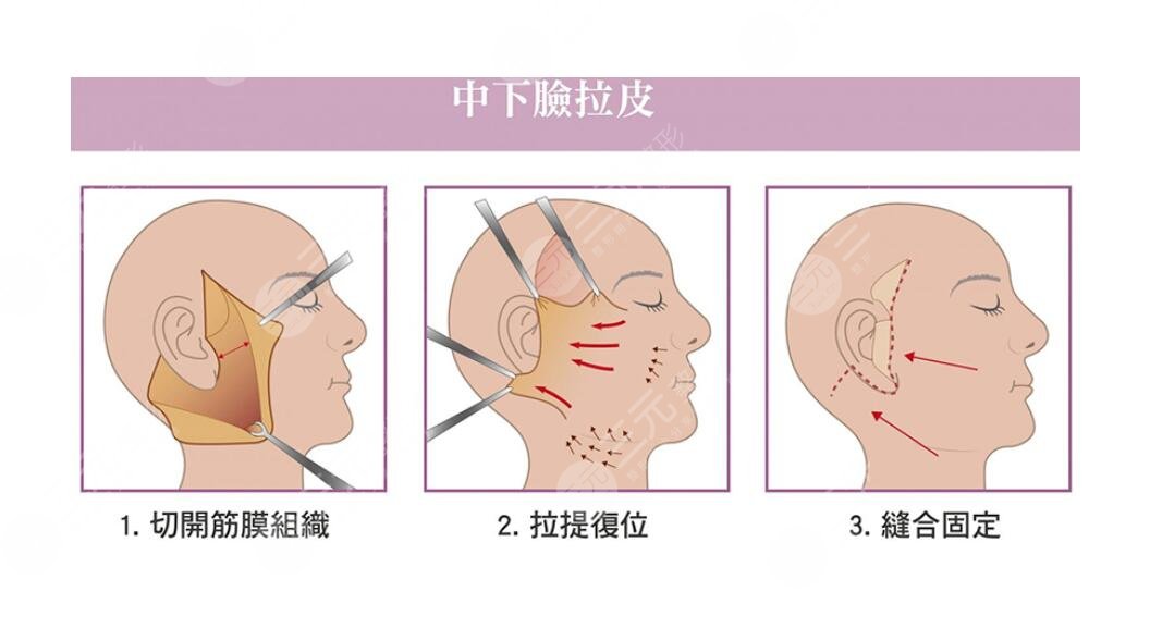 武漢藝星徐國建大拉皮做得怎么樣