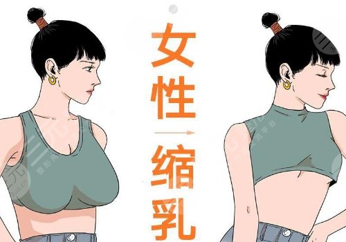 湘雅醫(yī)院乳房整形需要多少錢