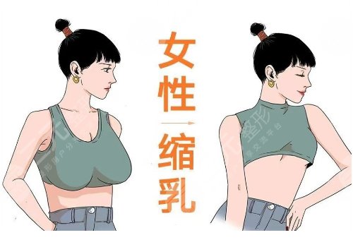 深圳北大醫(yī)院縮胸手術(shù)費用