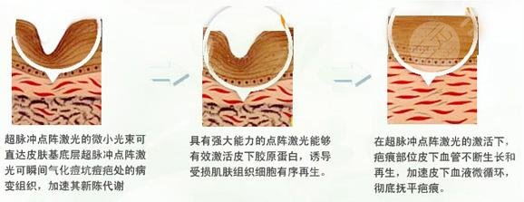 深圳市龍華人民醫(yī)院整形外科科室醫(yī)生信息