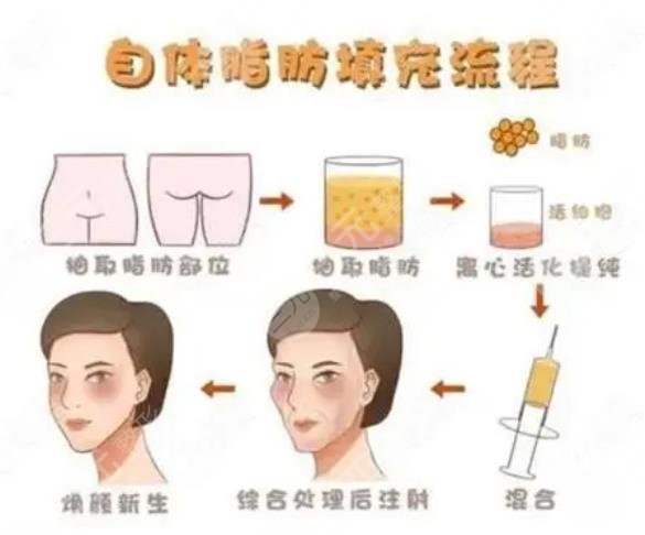武漢五洲整形醫(yī)院特色項目