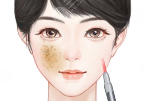 汕頭萊美醫(yī)療美容門(mén)診部祛斑價(jià)格