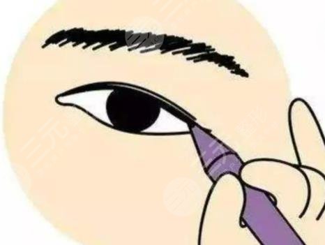 雙眼皮