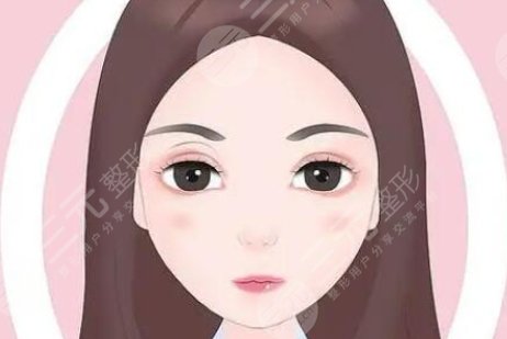 雙眼皮