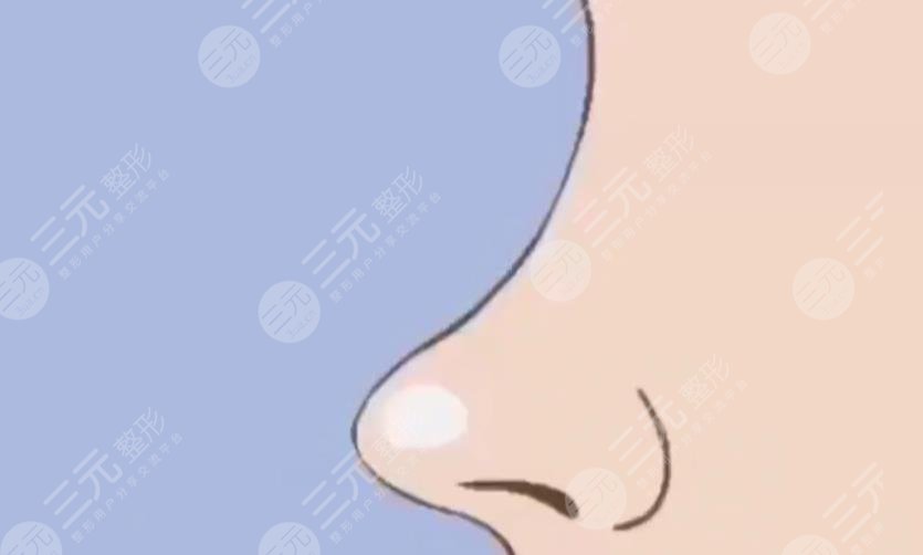 肋骨