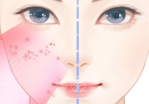非手術整形美容