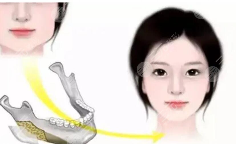 下頜角