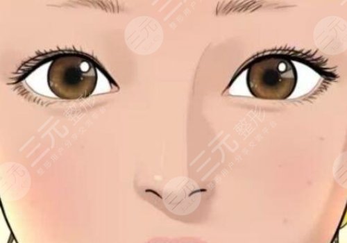 雙眼皮全切價(jià)格是多少