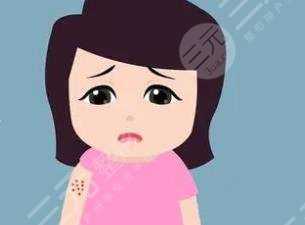 疤痕