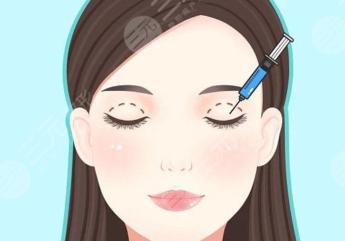 紀(jì)影暢雙眼皮