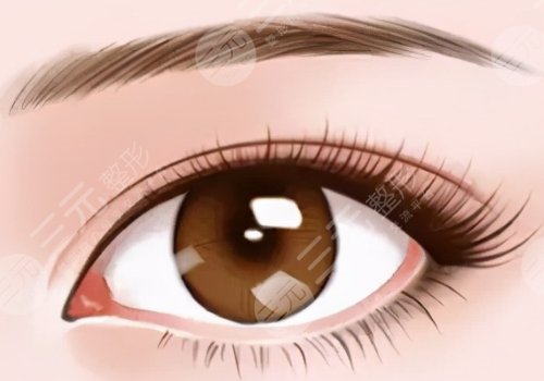 紀影暢雙眼皮案例