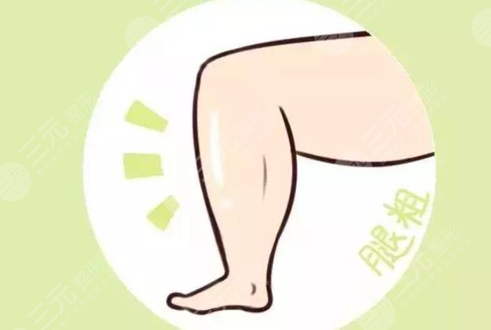 瘦腿