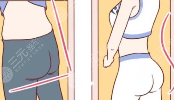 豐臀