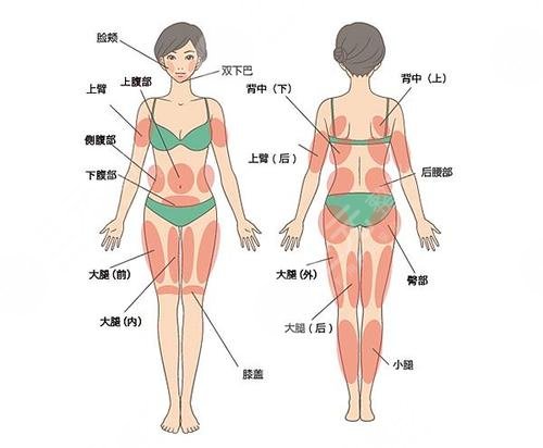 南京陳孝闖吸脂怎么樣?