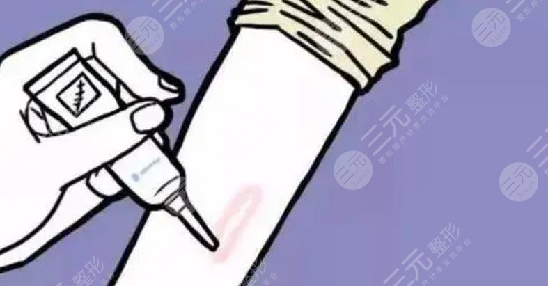 疤痕手臂