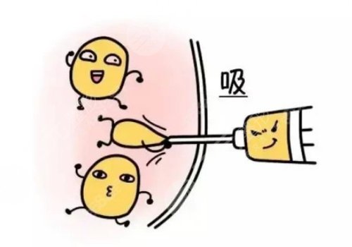 汕頭市中心醫(yī)院吸脂多少錢