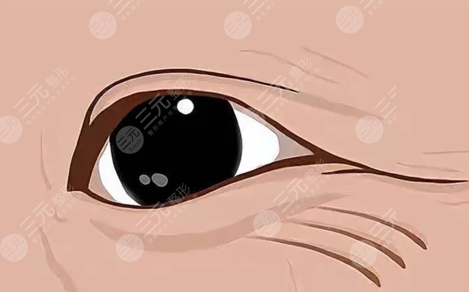 眼下干紋